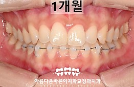 수술후