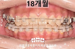 수술후