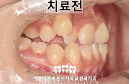 수술전