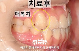 수술후