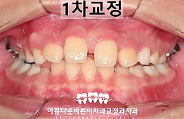수술후