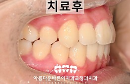 수술후