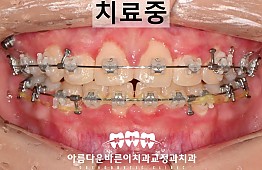 수술후