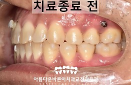 수술후