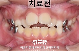 수술전