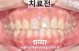 수술전