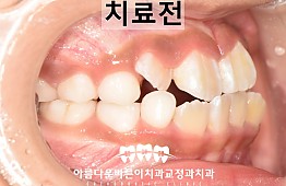 수술전