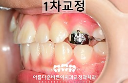 수술후