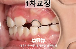 수술후