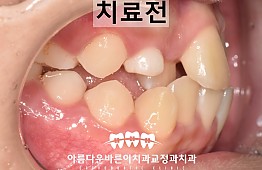 수술전