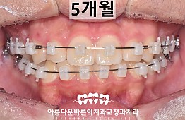 수술후