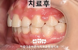 수술후