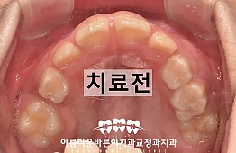 수술전