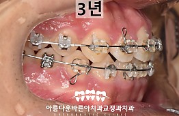 수술후