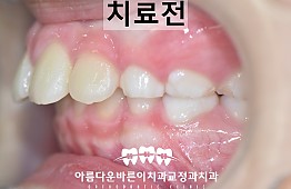 수술전