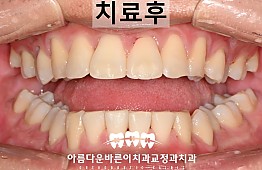 수술후