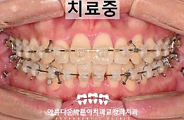 수술후