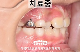 수술후