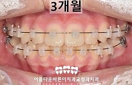 수술후