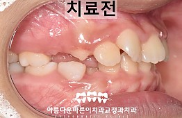 수술전