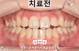 수술전