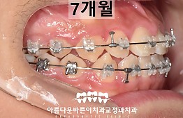 수술후