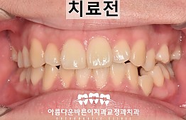 수술전