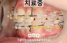 수술후