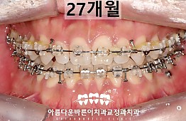 수술후