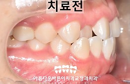 수술전