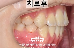 수술후