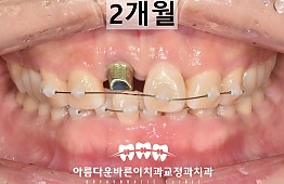 수술후