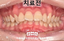 수술전