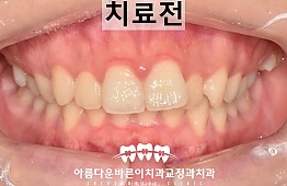 수술전