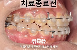 수술후
