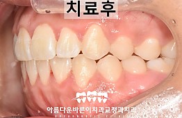 수술후