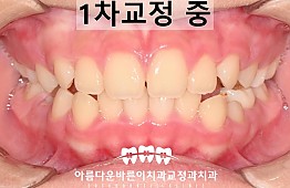 수술후