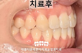 수술후