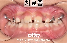 수술후